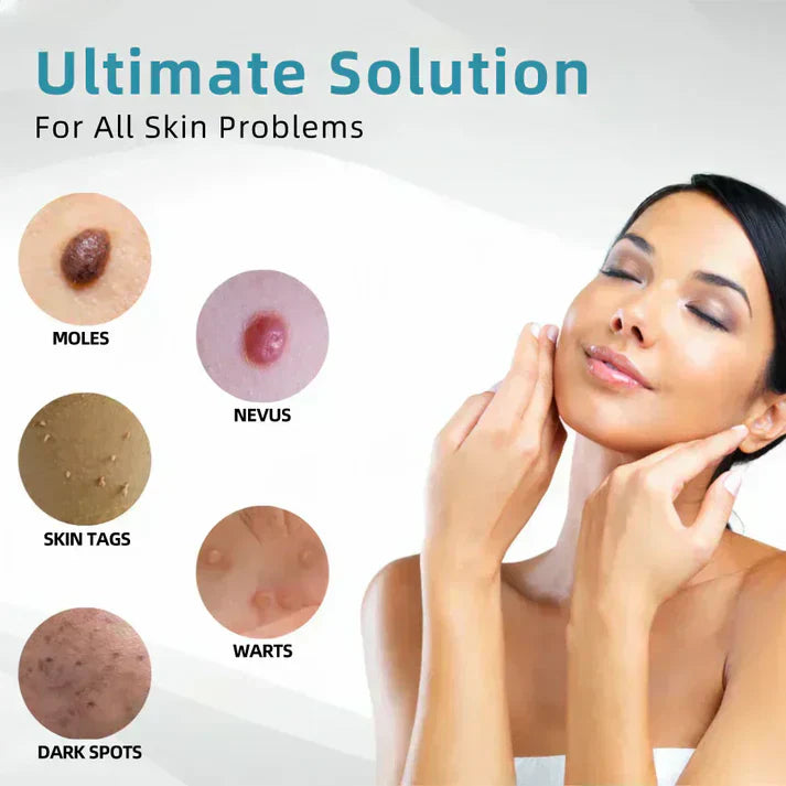 LUMIVO™ All-in-One CO₂ Laser Eraser Pen | Removes Moles, Warts, Skin Flaws & Pigmentation