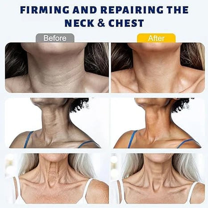 Reduces Wrinkles and Double Chin,Five Rollers for All Around Massage,Neck Firming Cream