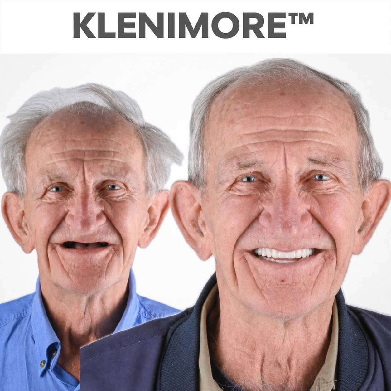 ⏰ KLENIMORE™ Custom-Fit Dentures  ENDS TODAY   70% OFF | Smile with Confidence