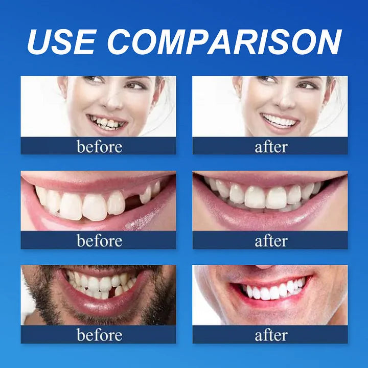 ⏰ Aurora Tech™ Custom-Fit Dentures  ENDS TODAY   70% OFF | Smile with Confidence