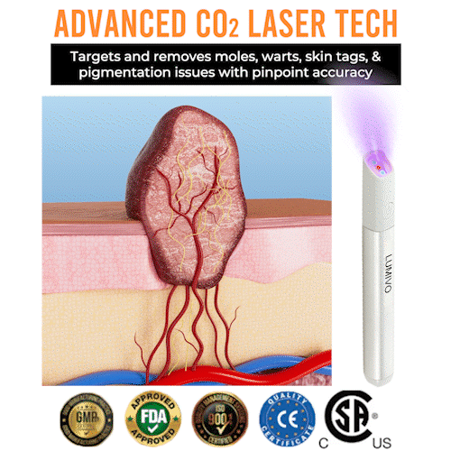 LUMIVO™ All-in-One CO₂ Laser Eraser Pen | Removes Moles, Warts, Skin Flaws & Pigmentation