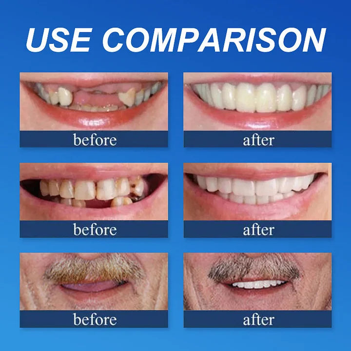 ⏰ Aurora Tech™ Custom-Fit Dentures  ENDS TODAY   70% OFF | Smile with Confidence